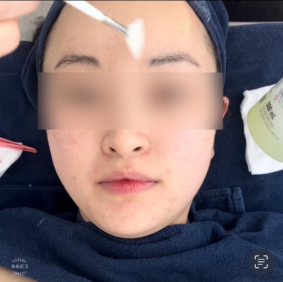 베카로움 이미지