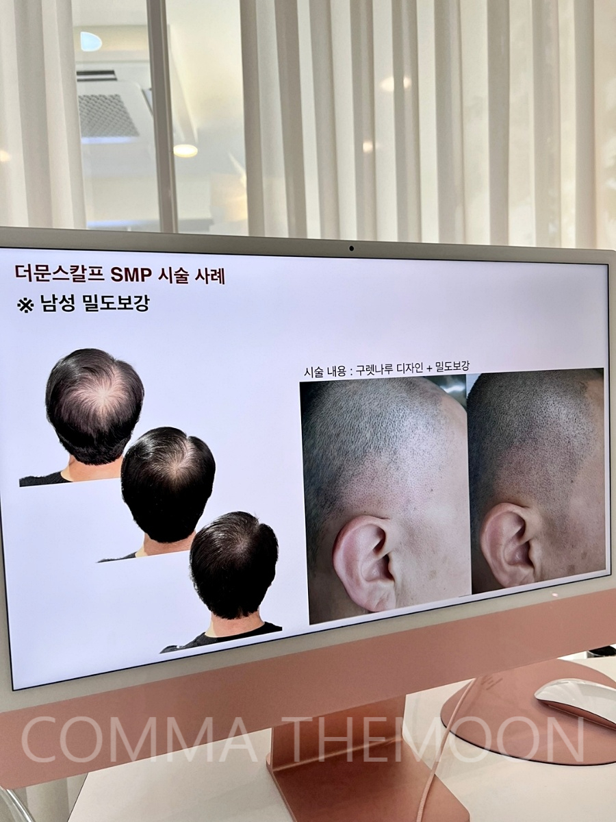 콤마더문 이미지