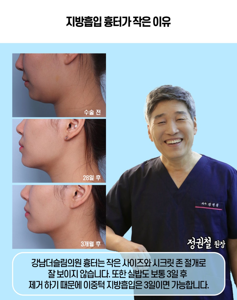 강남더슬림의원 이미지