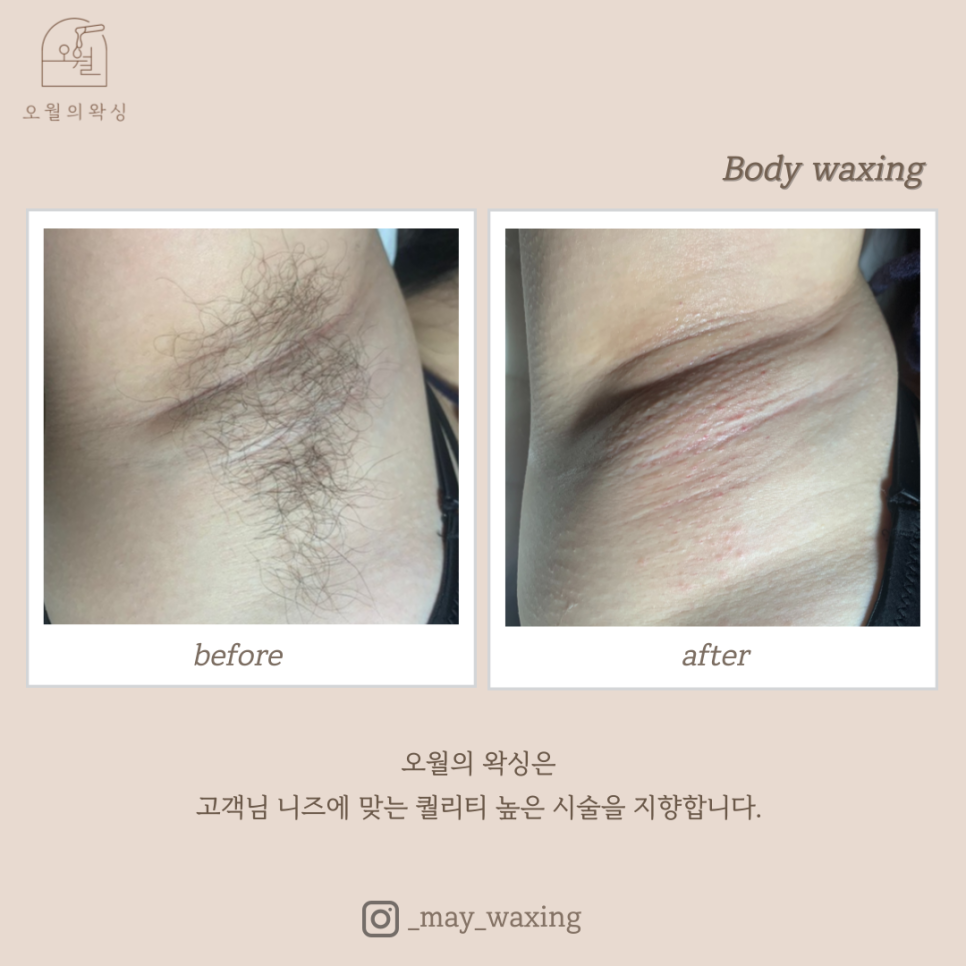 오월의 왁싱 이미지