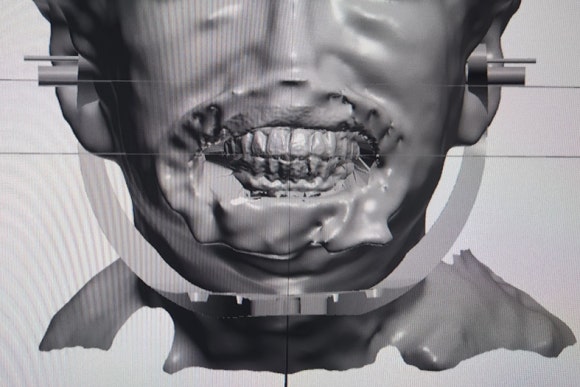 별가람시스템 이미지