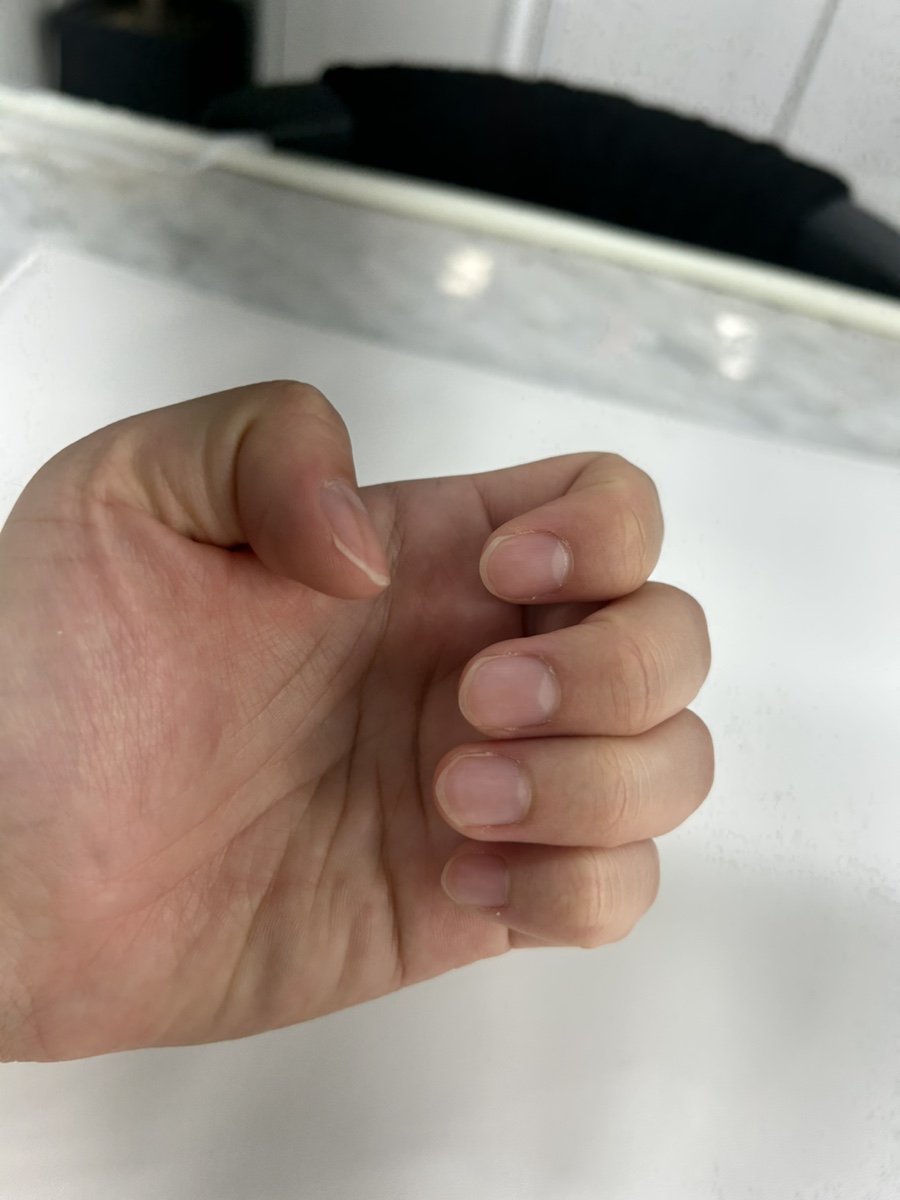 520네일 이미지