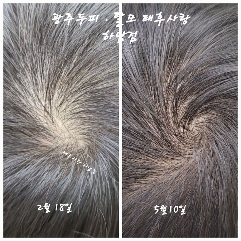 두피·탈모태후사랑하남점 이미지