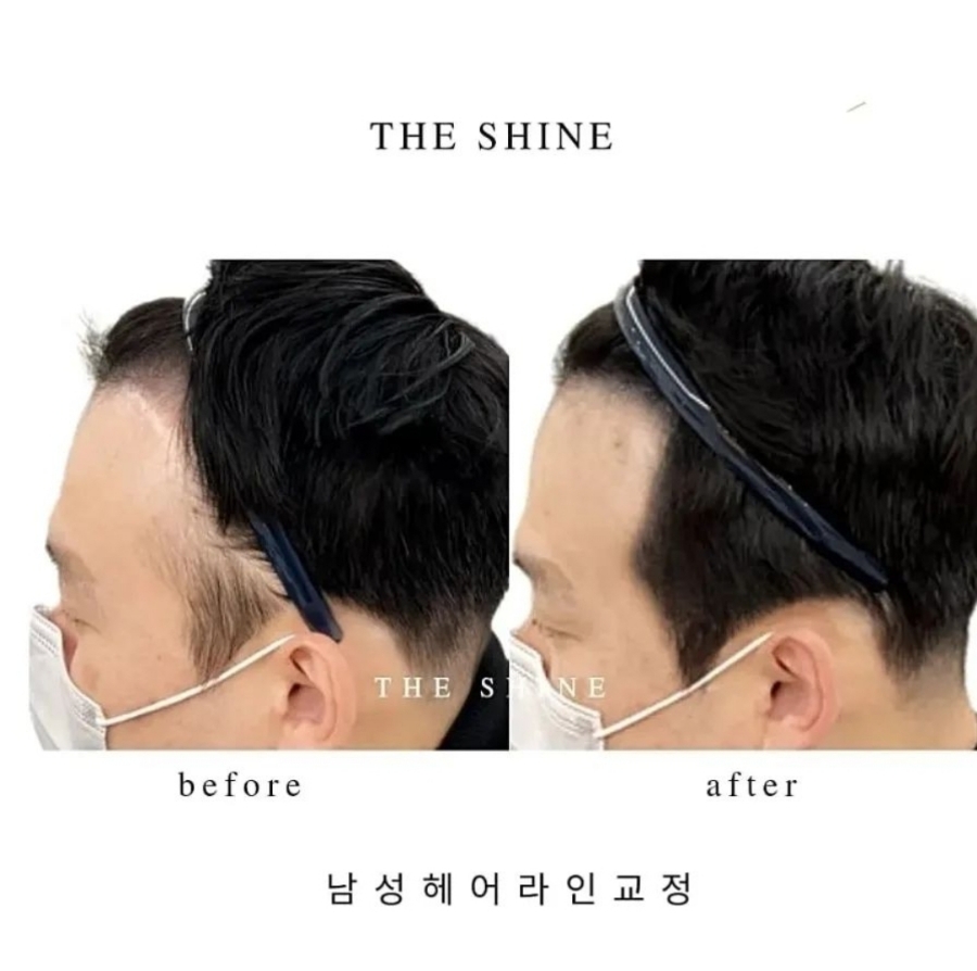 더샤인 이미지