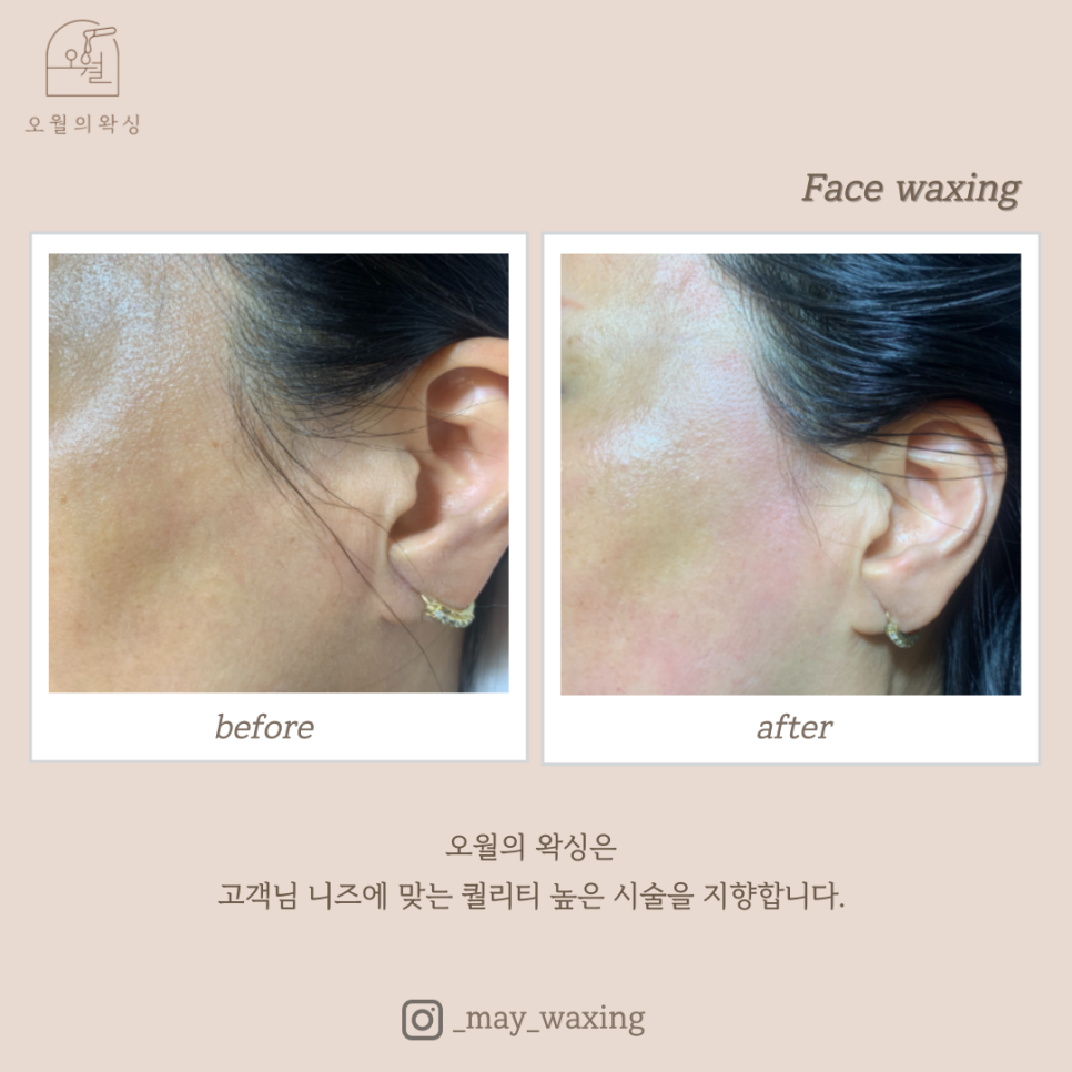 오월의 왁싱 이미지