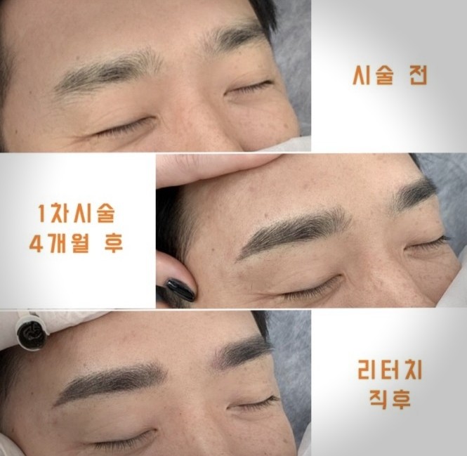 타미제뷰티 이미지