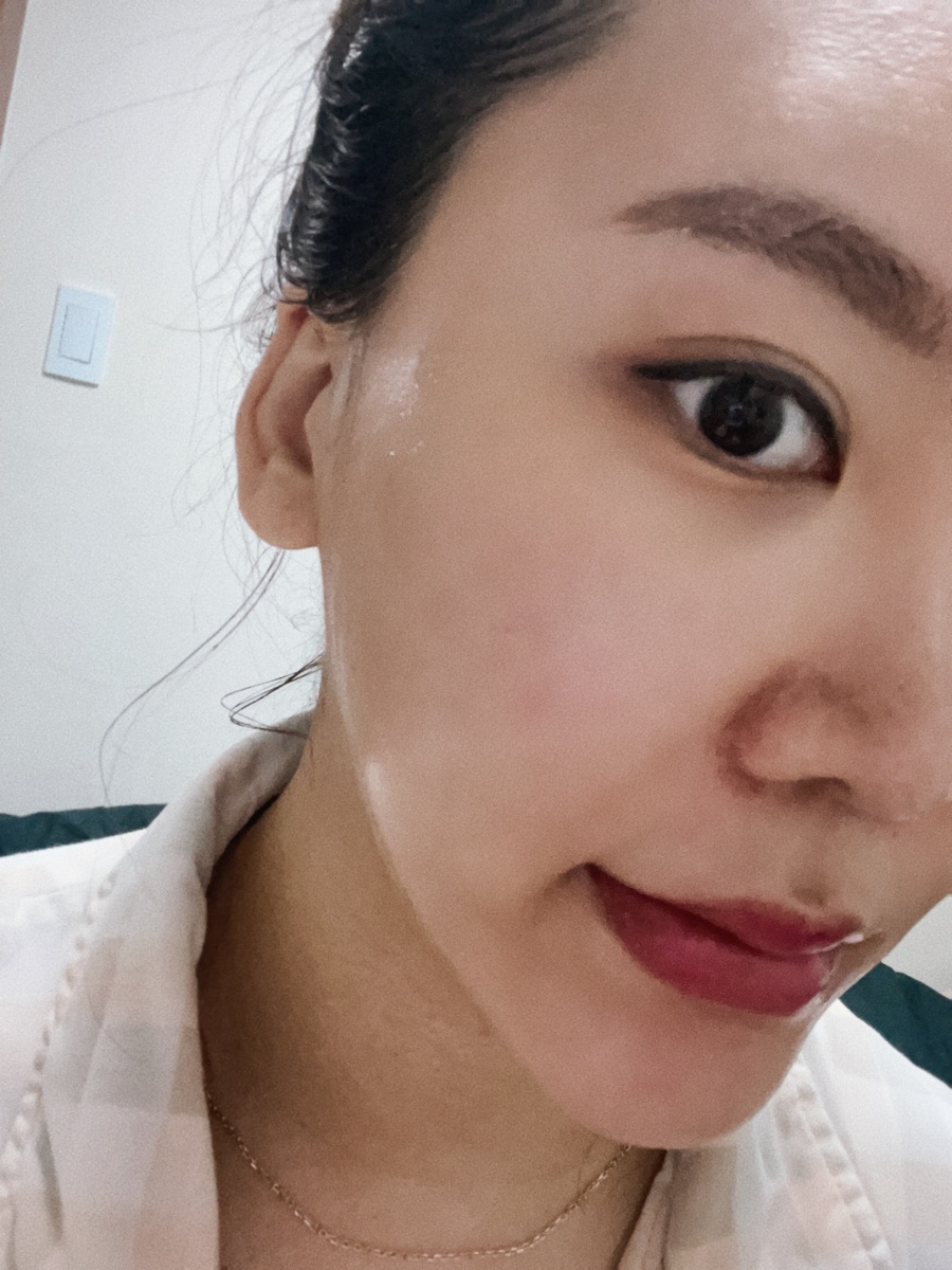더포레스트스킨 이미지