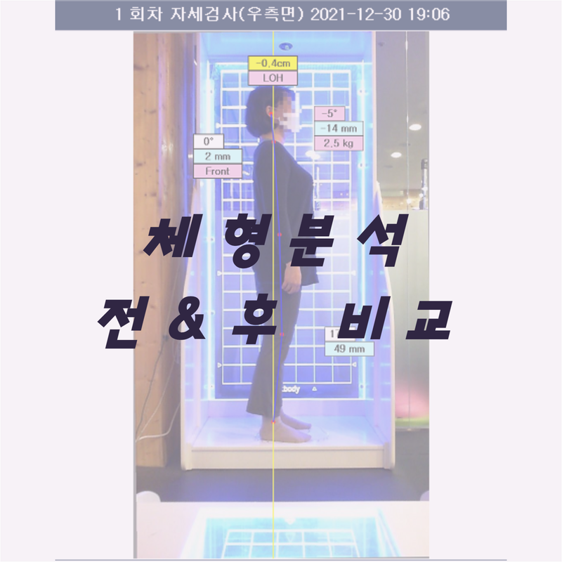 라온체형교정센터 이미지