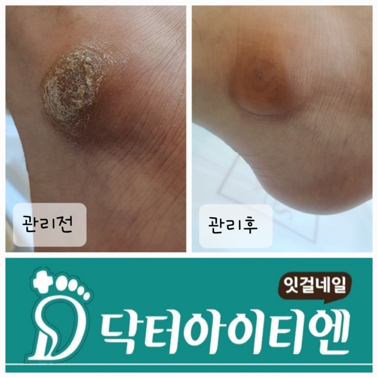 허네일 이미지
