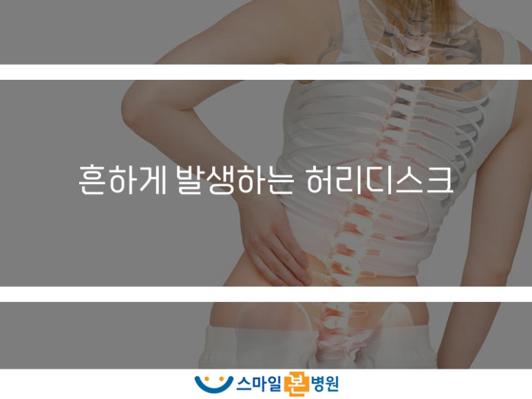 스마일신경외과 이미지