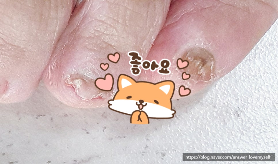 힐앤풋 이미지