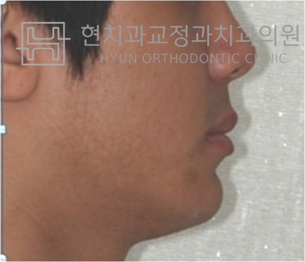 올바른현치과 이미지