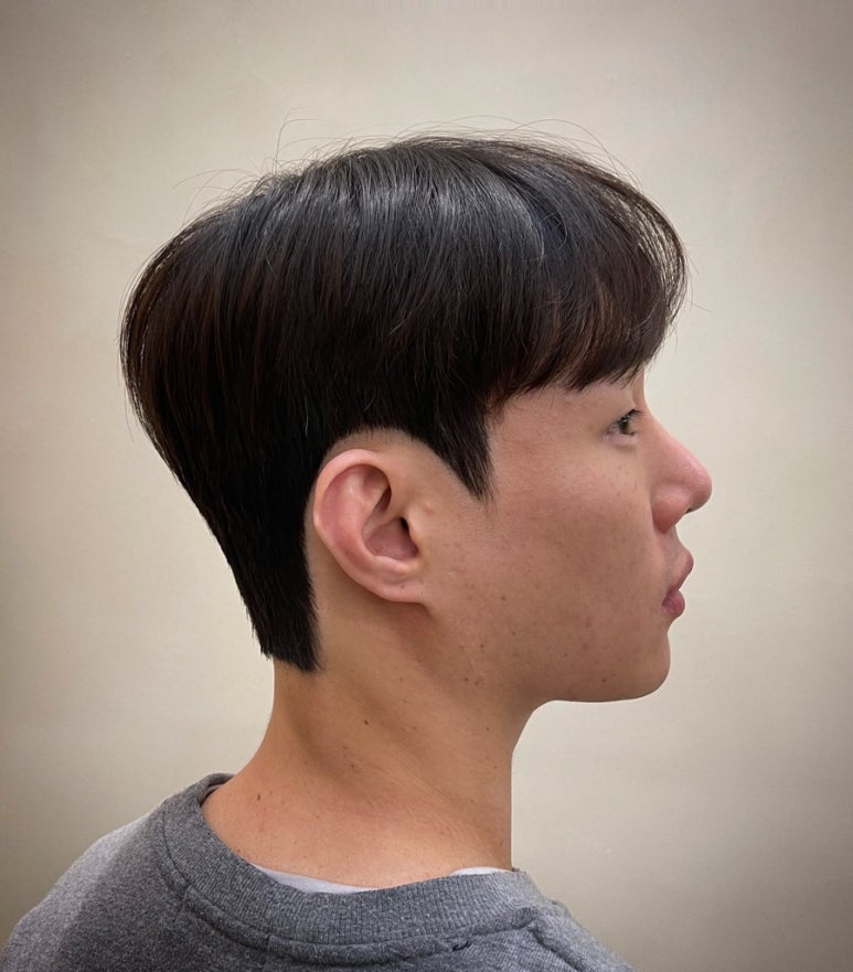 마이트로포 이미지