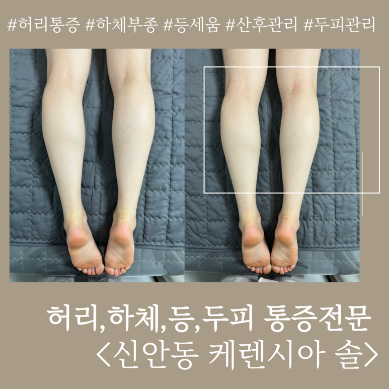 케렌시아 솔 이미지
