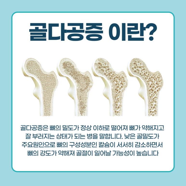 서울아산정형외과 이미지