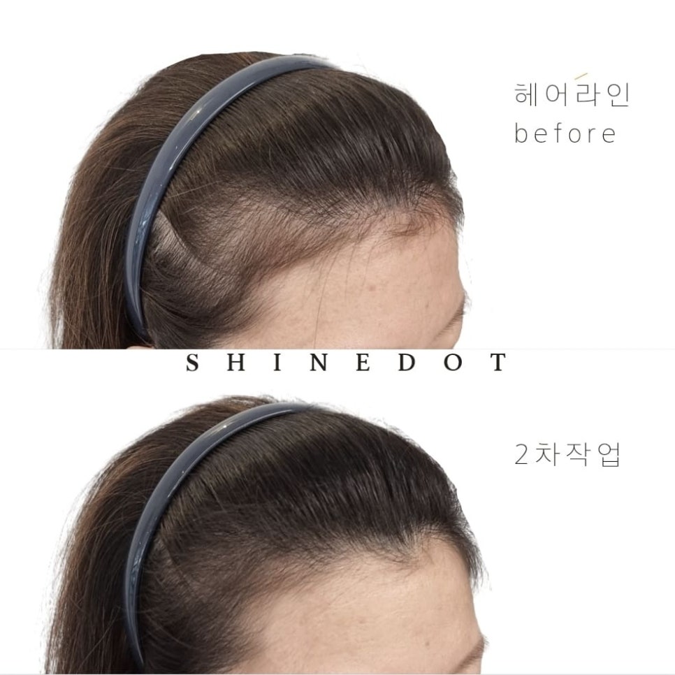 샤인도트 이미지