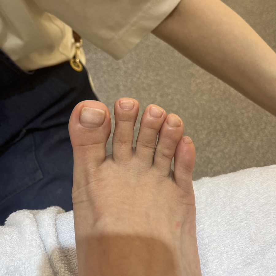 엘핀네일 이미지