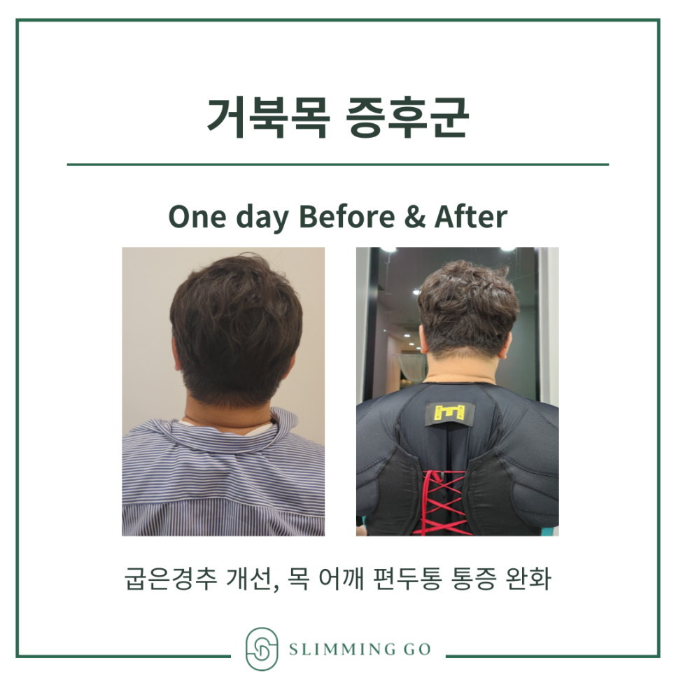슬리밍고 이미지