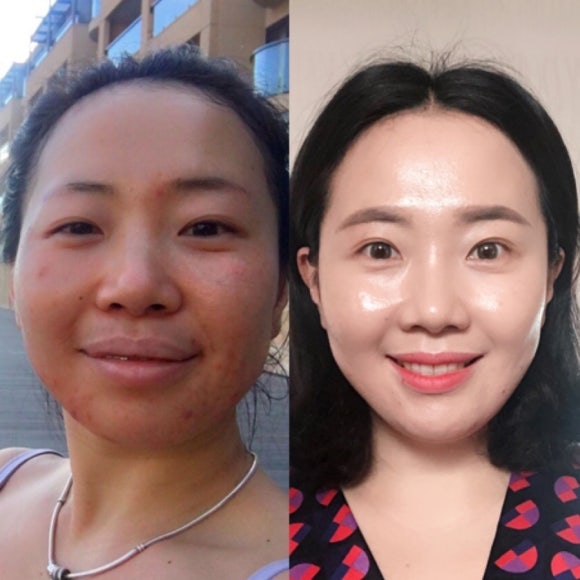 신데렐라스킨케어 이미지