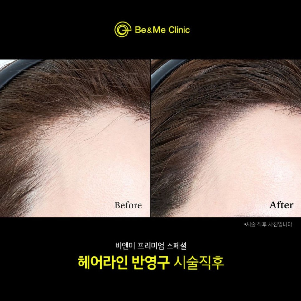 헤어라이 이미지