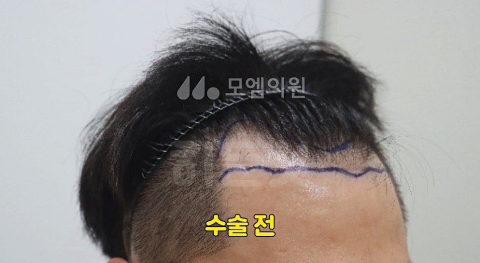 오던모발 이미지