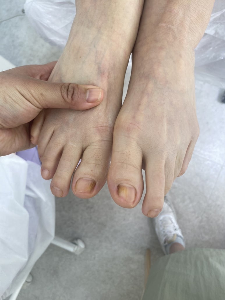 이천문제성발전문#라파엘 이미지