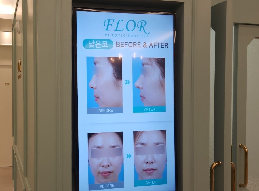플로르성형외과 이미지