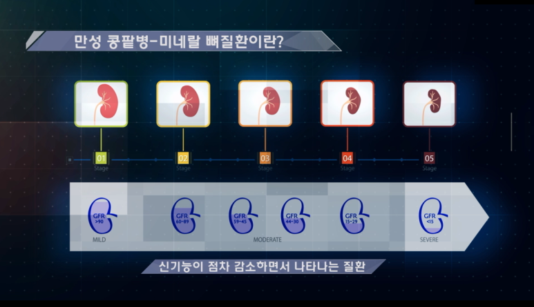 고려피알 이미지