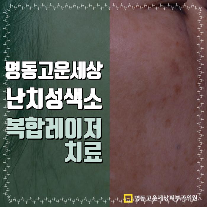 명동고운세상피부과의원 이미지
