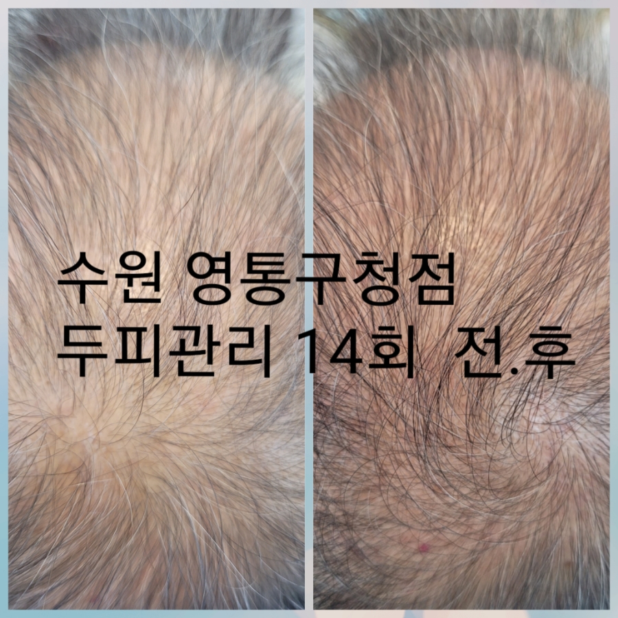 이승미샵 이미지
