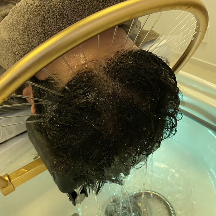 윤두피SPA 이미지