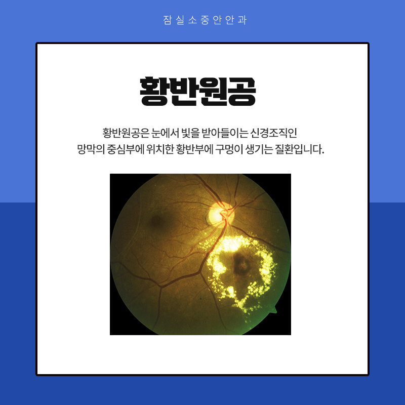 잠실소중안안과의원 이미지