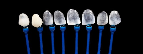 무삭제 라미네이트 보철물 얇기를 보여주는 여러 보철물 사진 