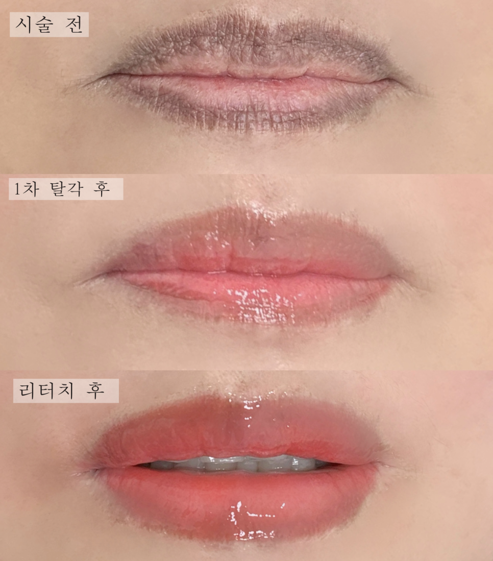 라블랑뷰티 이미지