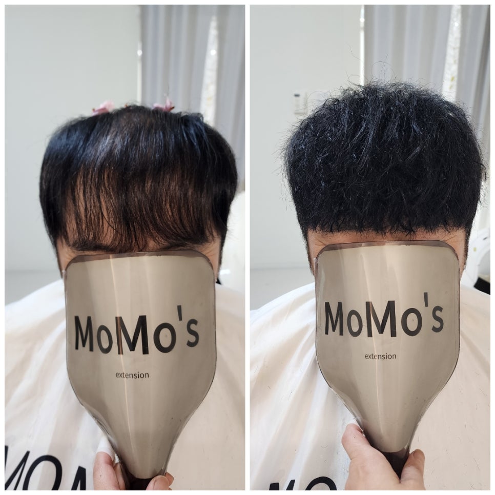 모모즈헤어&증모 이미지