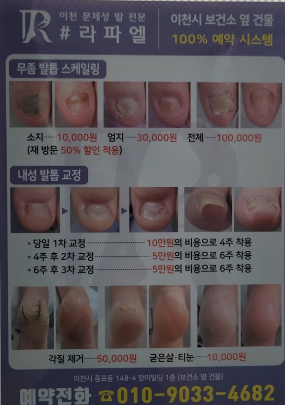 이천문제성발전문#라파엘 이미지