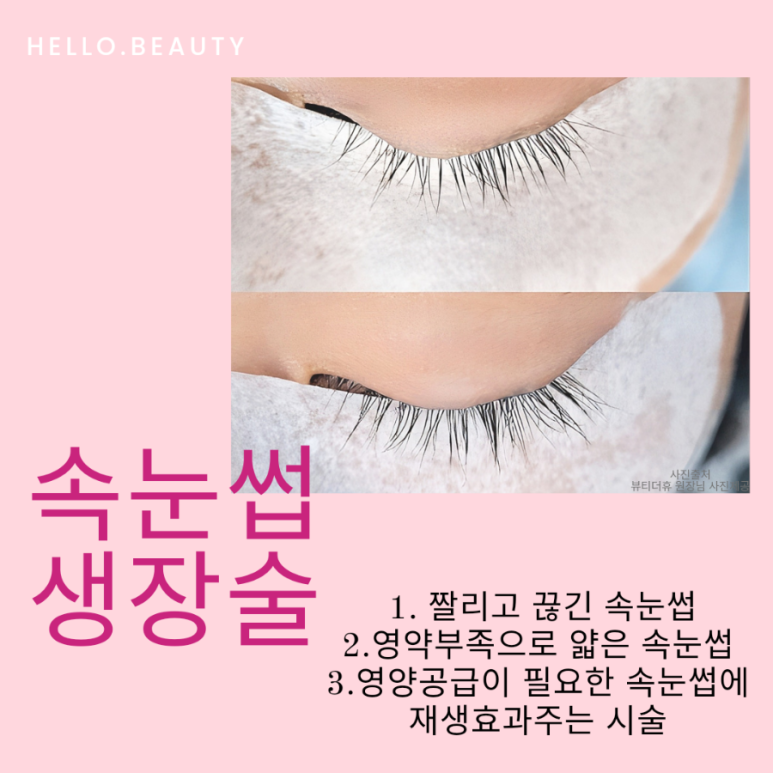 뷰티건강샾 이미지