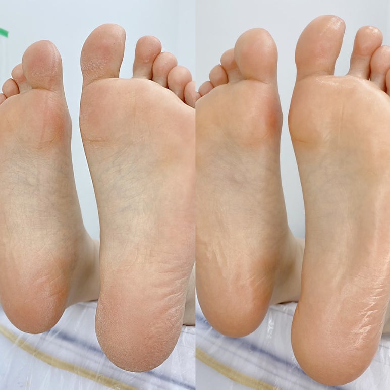 솜이 뷰티 이미지