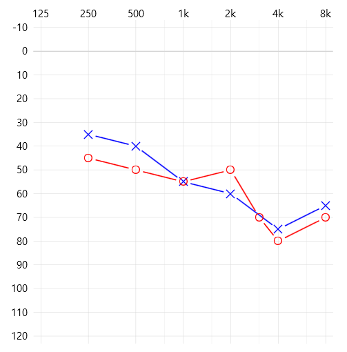 보청기로 TV를 더~~ 잘 듣는 방법 — 원문 이미지 2