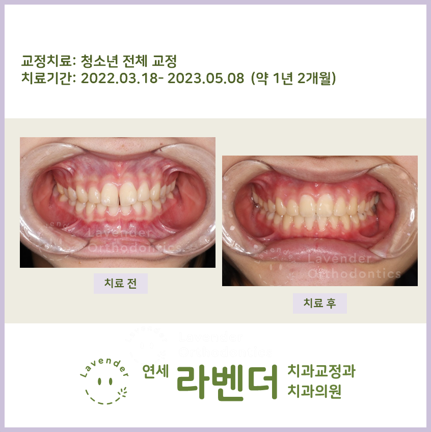 연세라벤더치과교정과치과의원 이미지