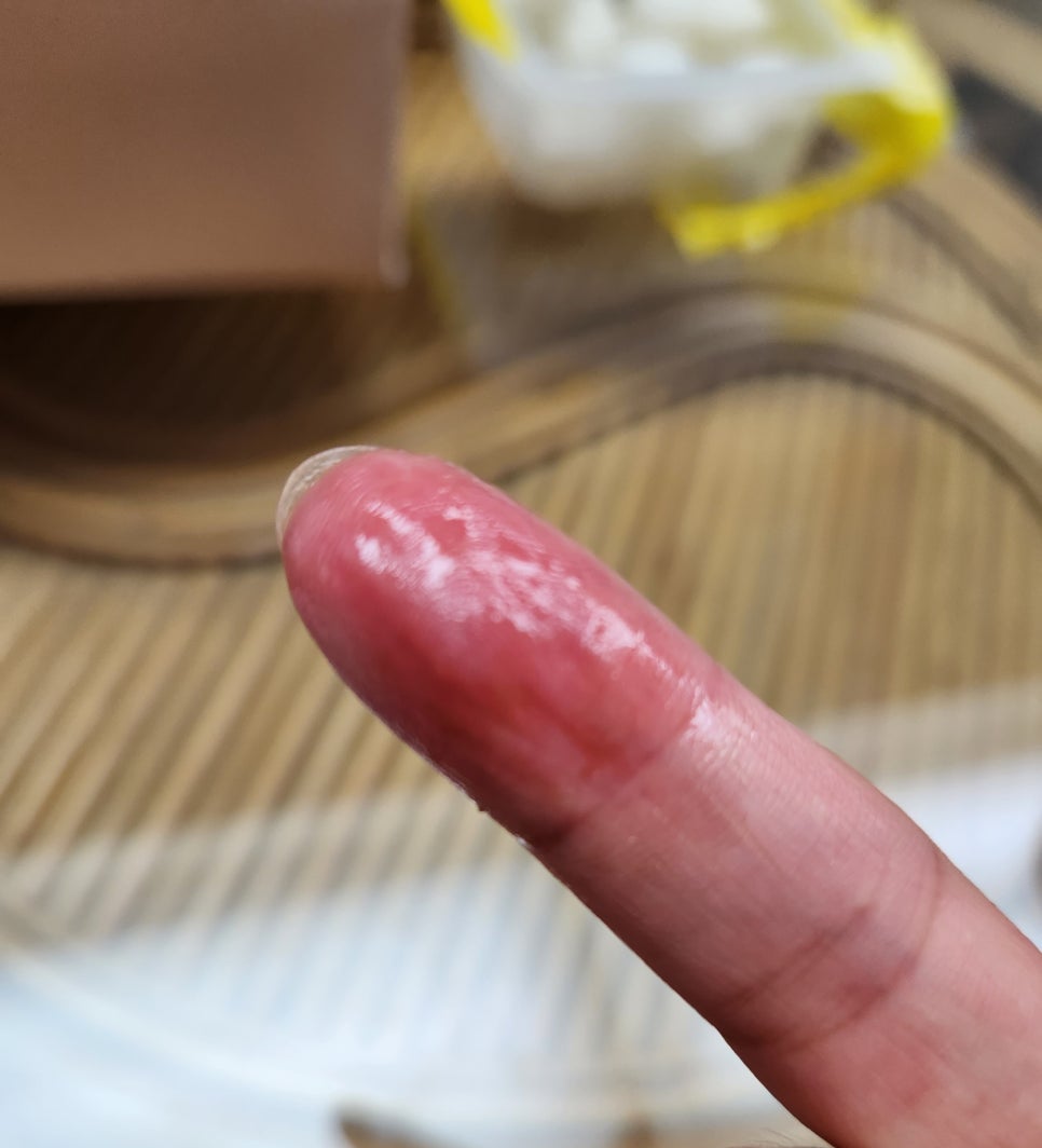 비에이치시 이미지
