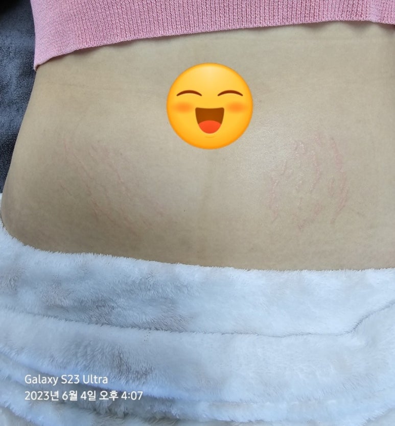천안탈모튼살스킨커버아카데미 이미지