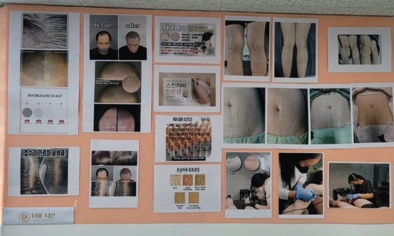 천안탈모튼살스킨커버아카데미 이미지