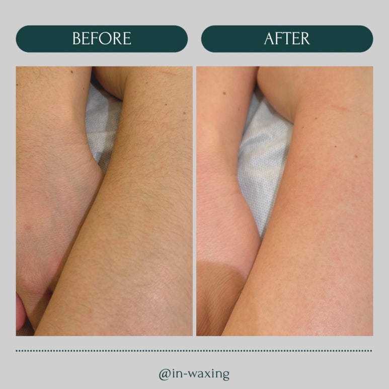 in_waxing 이미지