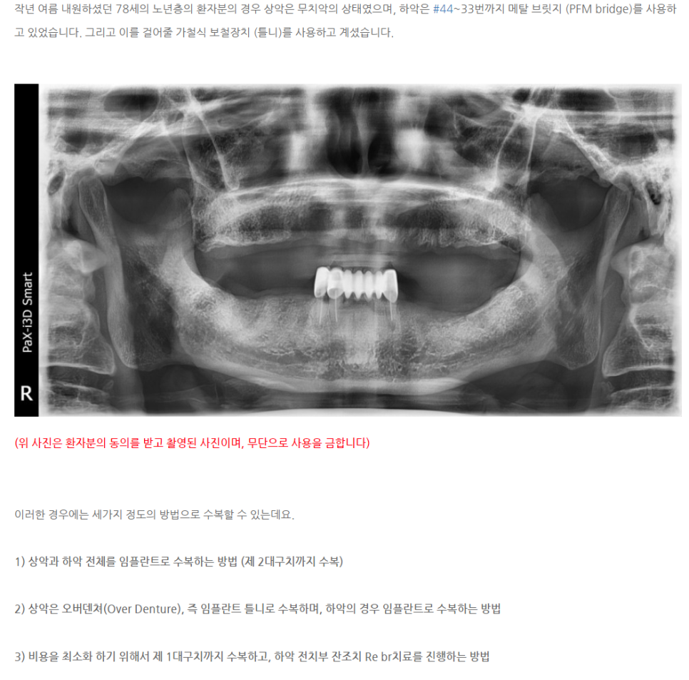 탄탄치과 이미지