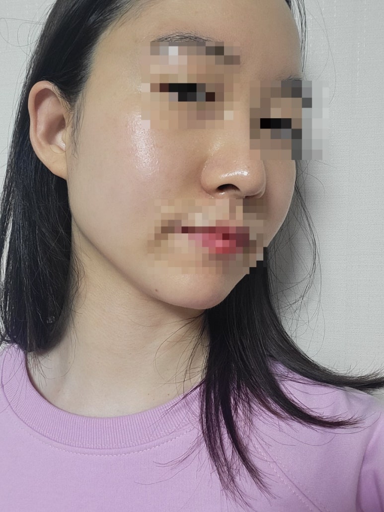 제이제이에스테틱 이미지