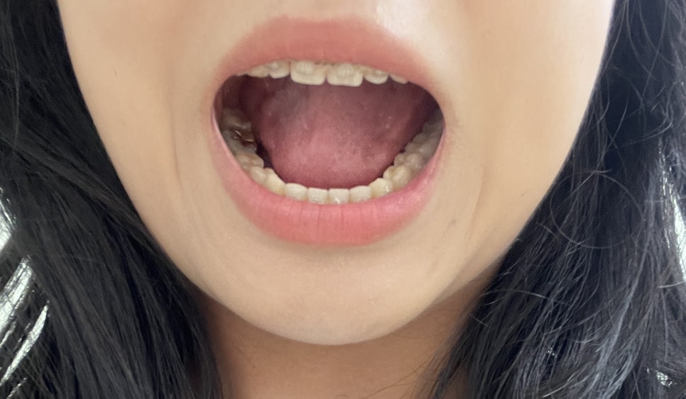 보스톤탑치과의원 이미지