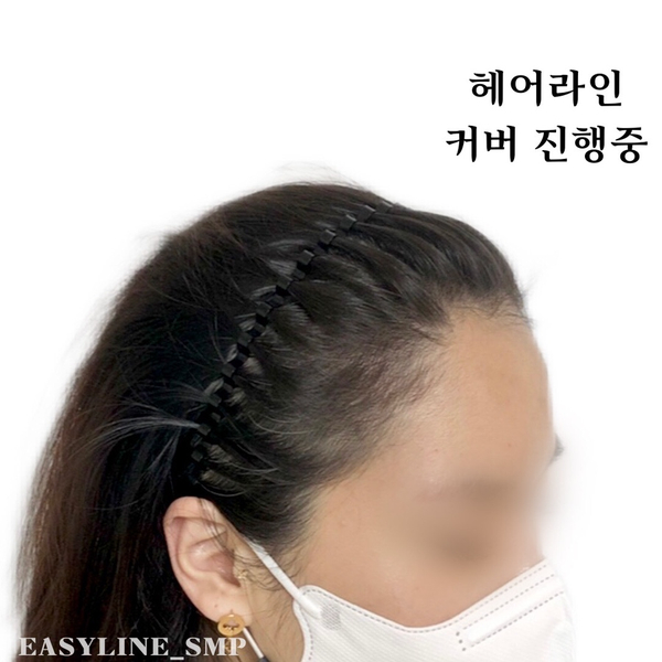 이지헤어라인 이미지