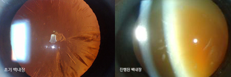 다누네일 이미지