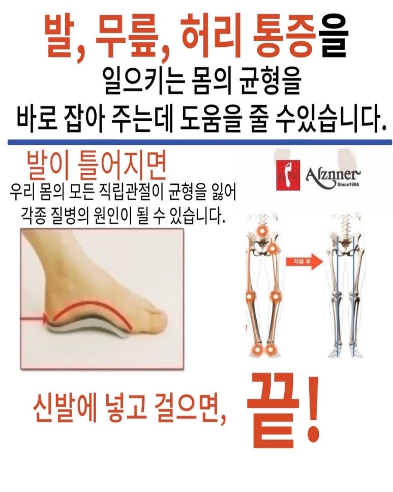 알즈너대한 이미지
